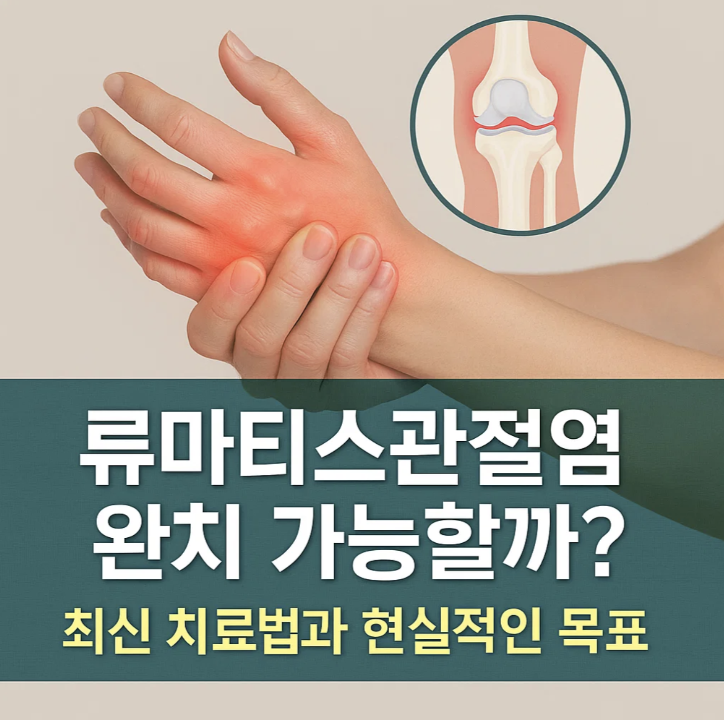 류마티스관절염 완치 가능할까? 최신 치료법과 현실적인 목표