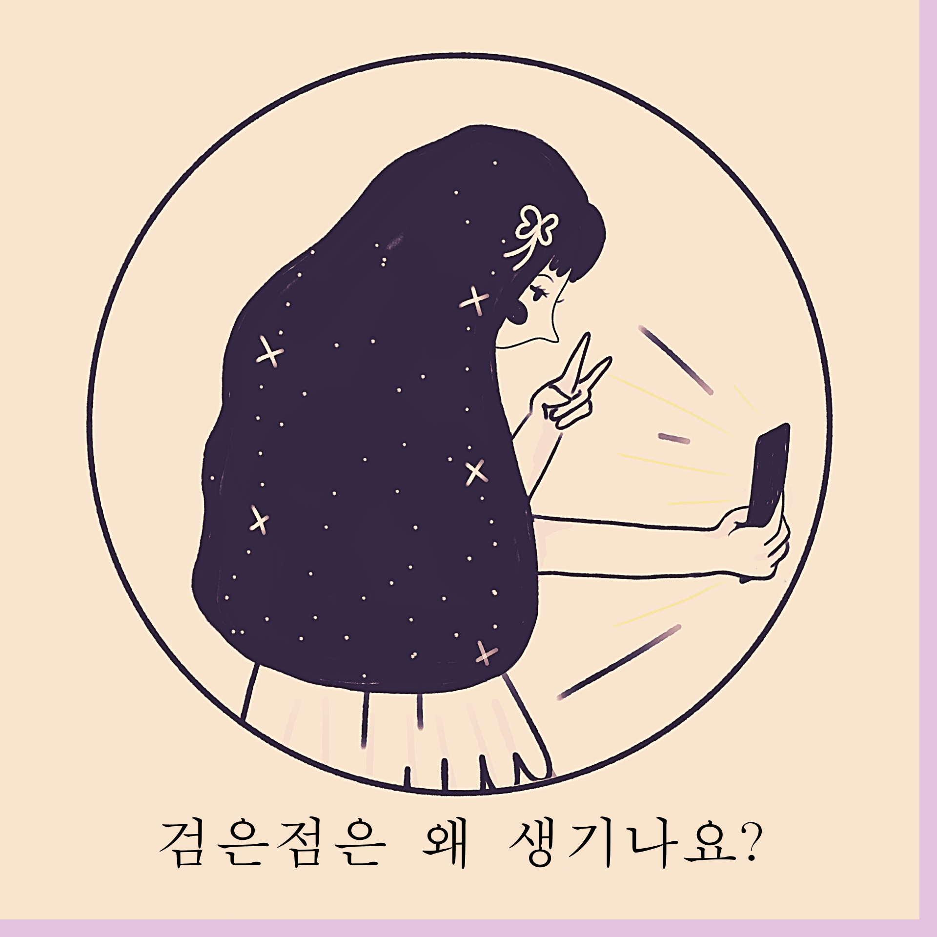 검은 점은 왜 생기나요