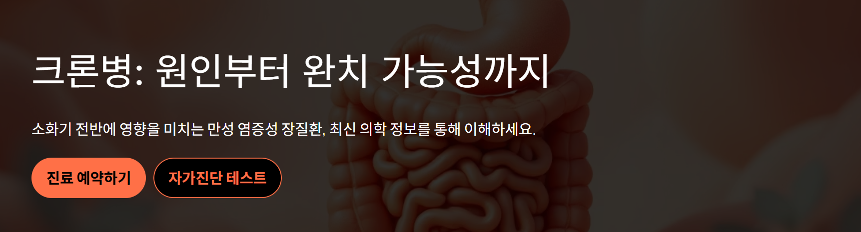 크론병 원인과 치료