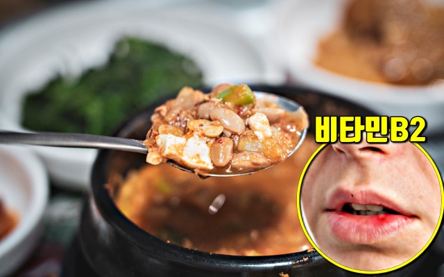 입안이 자주 헐때 좋은 음식 청국장 효능,입병이 자주나는 이유,구순염