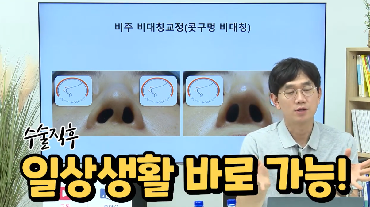 일상생활 바로 가능