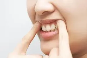 치아