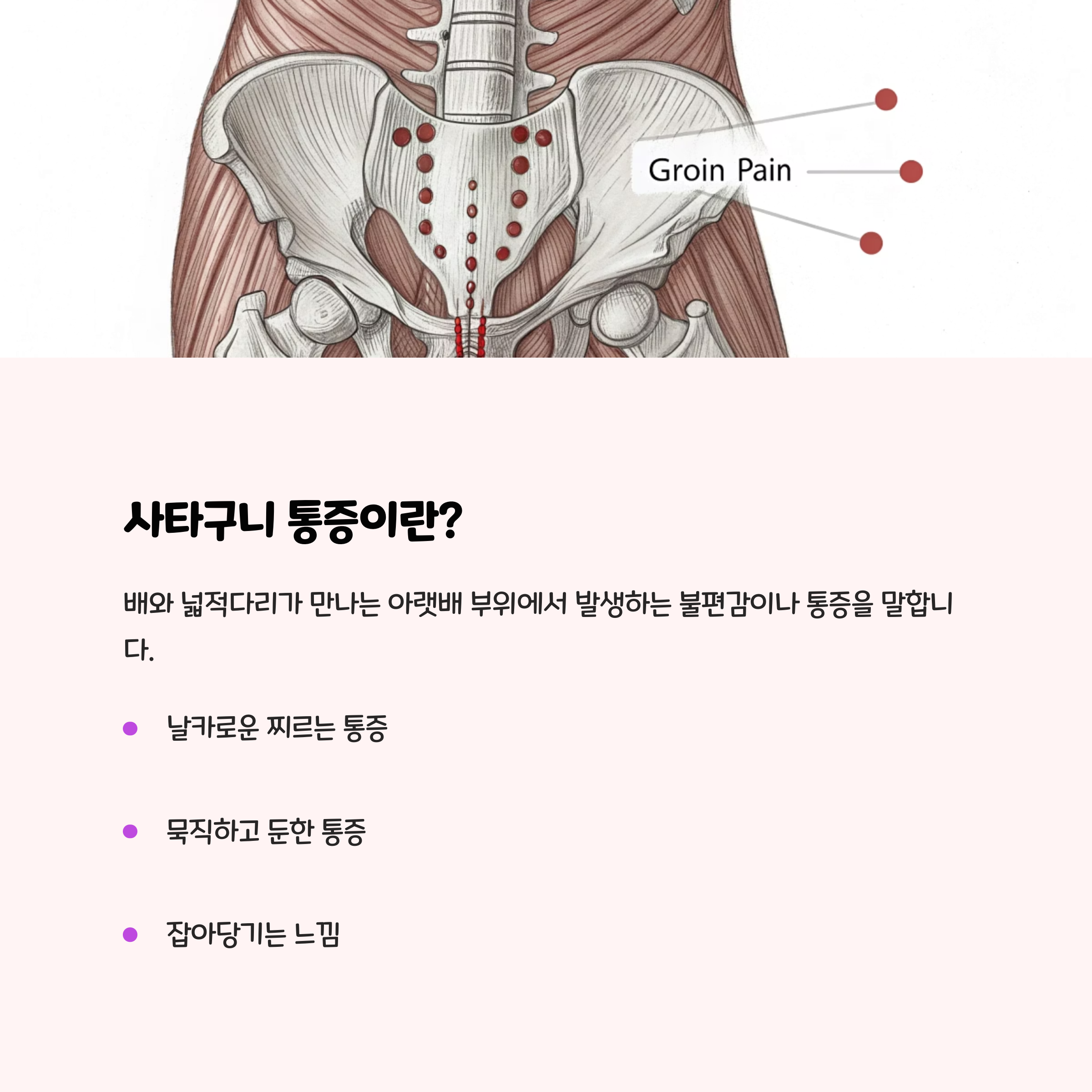 오른쪽 사타구니 통증, 정체가 뭘까? 🧐
