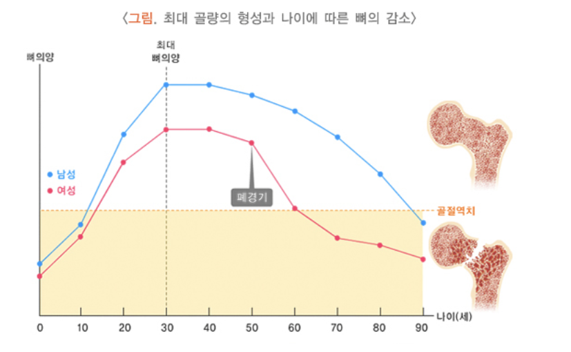 나이에 따른 뼈의 감소