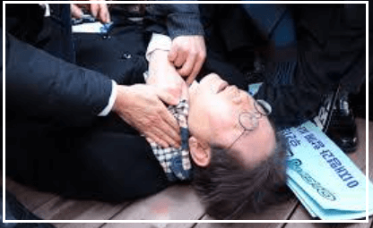 이재명 피습범 신상 파랑왕관 정치권반응 경정맥 손상