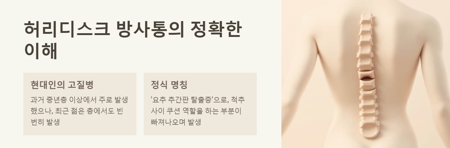 허리디스크 방사통