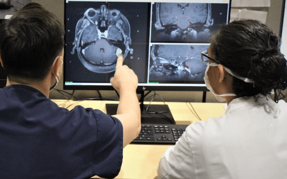 감마나이프 수술비