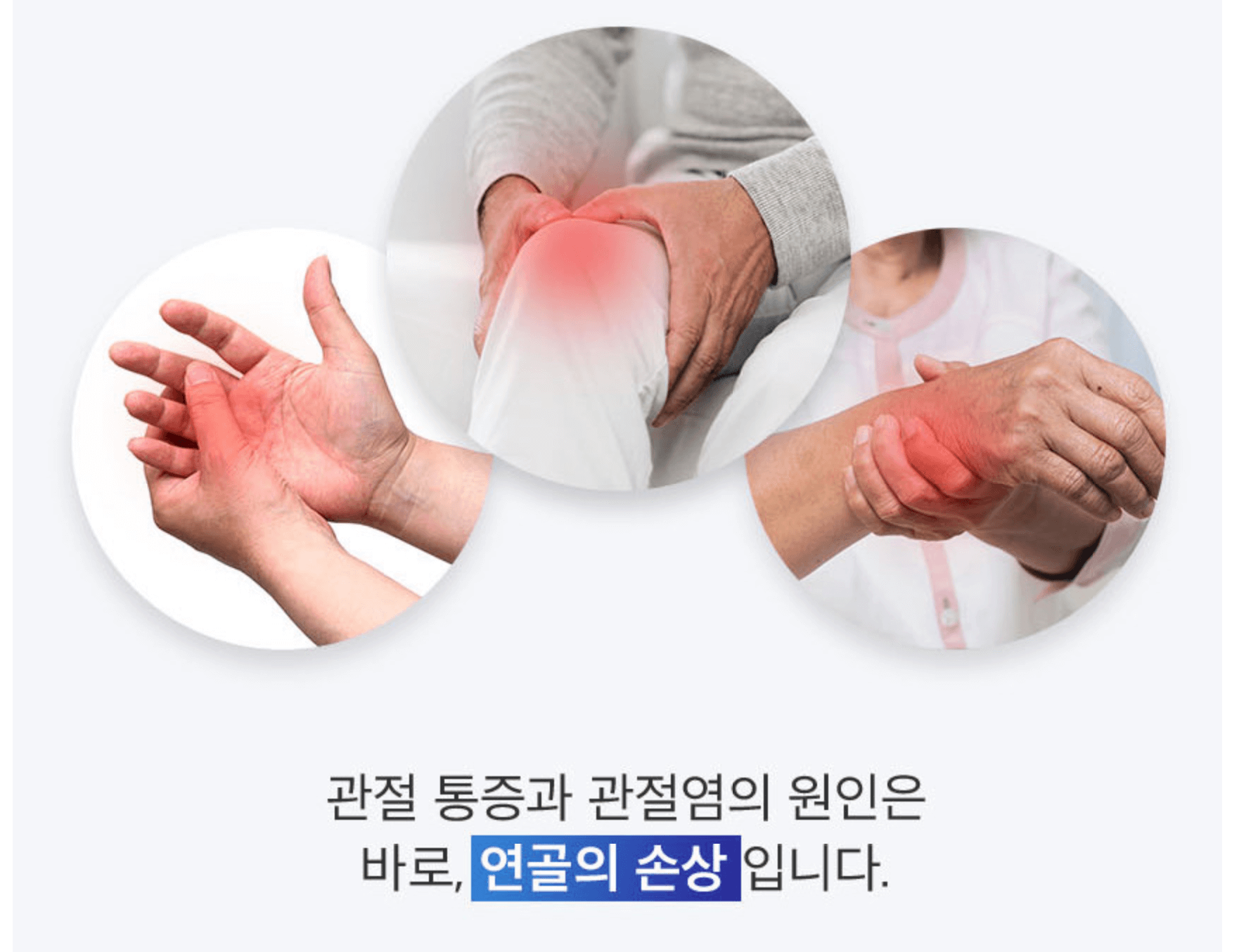 콘드로이친 1200 효과