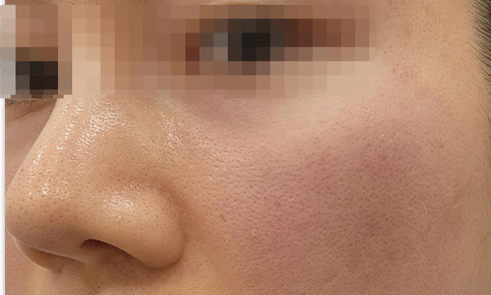 아이올리지오 후기