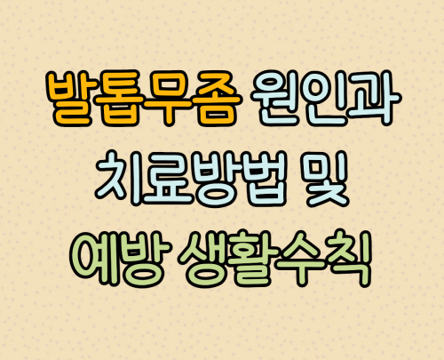 발톱무좀 원인과 예방 생활수칙