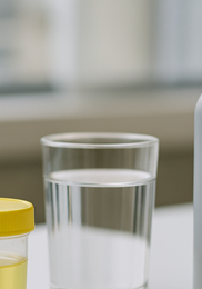 소변 색깔로 보는 건강 &amp;#124; 정상 색&amp;#44; 이상 신호&amp;#44; 병원 방문 기준