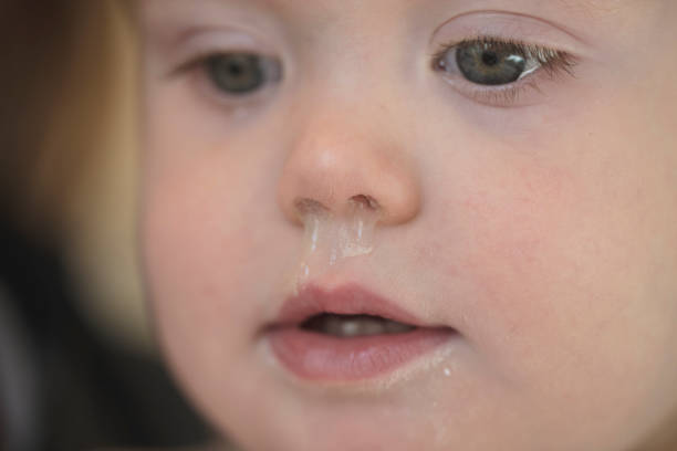 비염에 걸린 아기