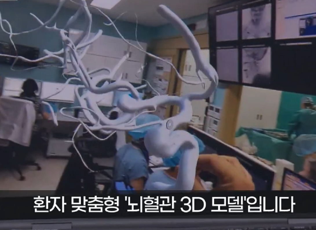 EBS-명의-뇌동맥류-윤원기-교수-뇌혈관3D모델