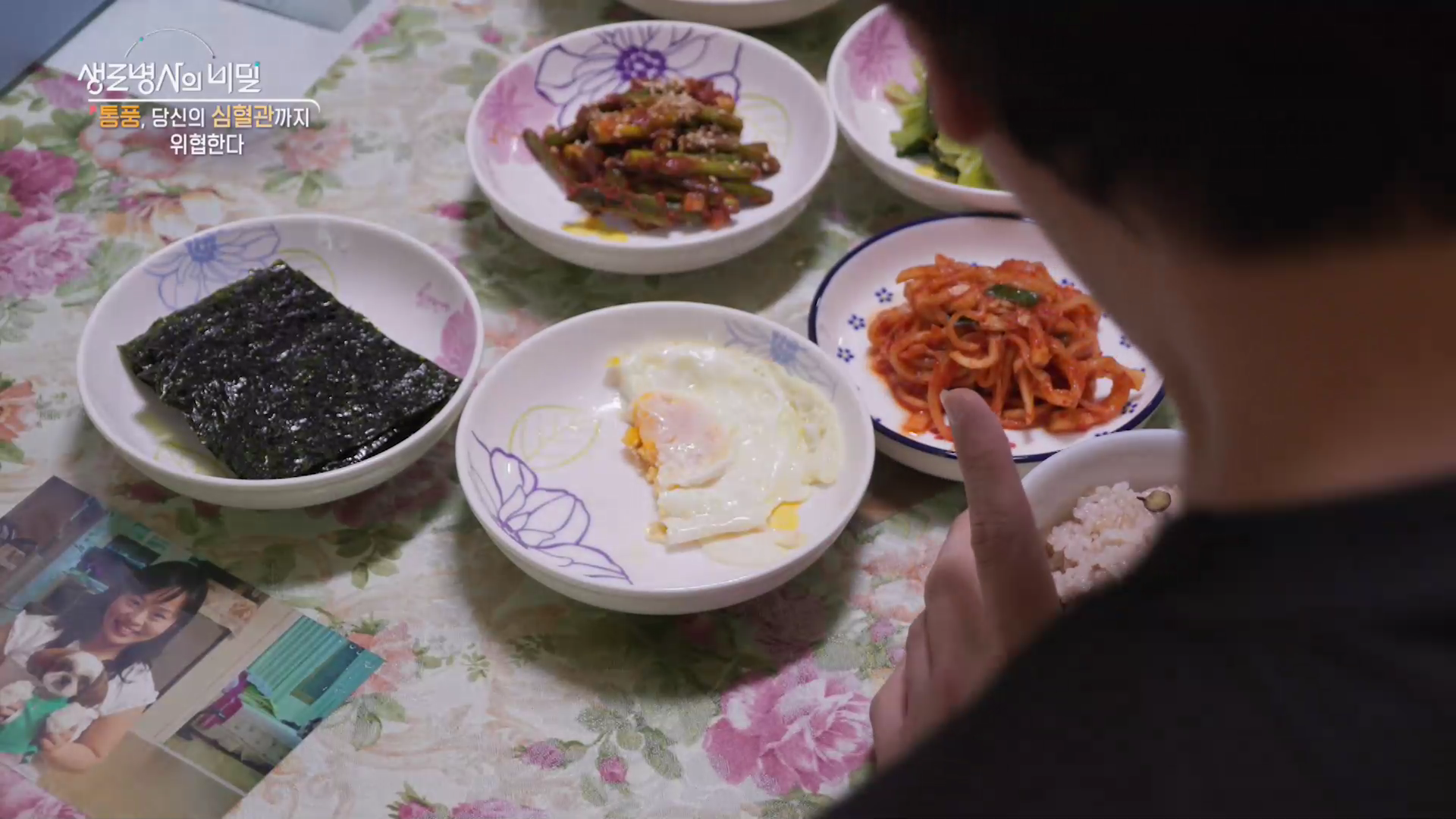 생로병사의 비밀 통풍
