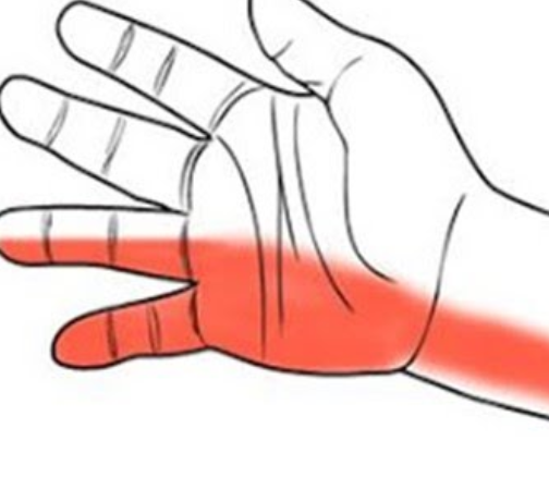 왼손 저림증상 원인 해결방법