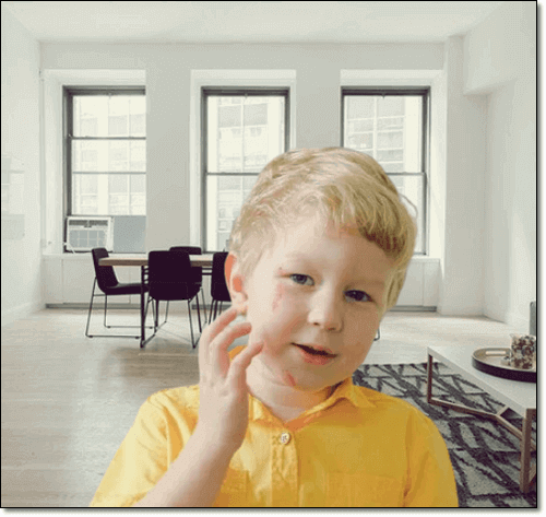 상처 치유에 도움이 되는 바셀린