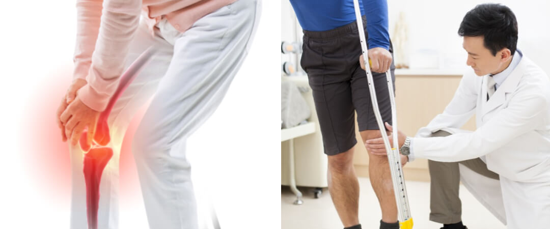 무릎통증으로 무릎을 주무르는 사진 / 무릎을 살펴보는 의사 사진