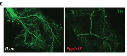 Credit:Kyohei Tokizane et al . DMHPpp1r17 neurons regulate aging and lifespan in mice through hypothalamic-adipose inter-tissue communication . Cell Metabolism (2024)