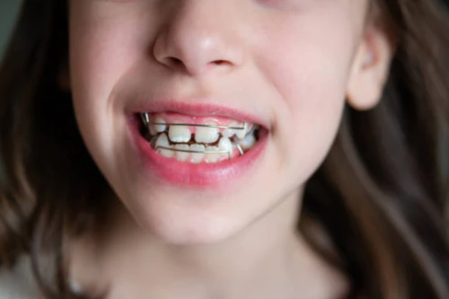 치과 교정비용 연말정산 3