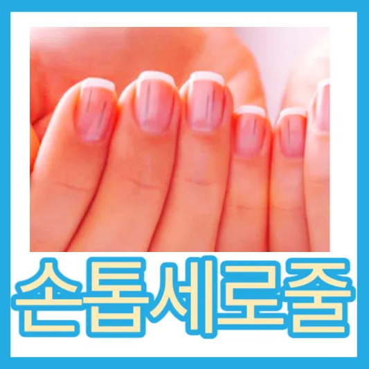흑색종 손톱에검은세로줄 원인 증상 치료