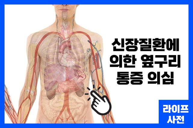 신장 문제는 감염이 방광에서 퍼질 때 옆구리 통증 의심될 수 있습니다