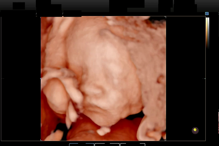 분류 모델이 자동으로 분류한 경우 (가장 신뢰도가 높은 이미지)