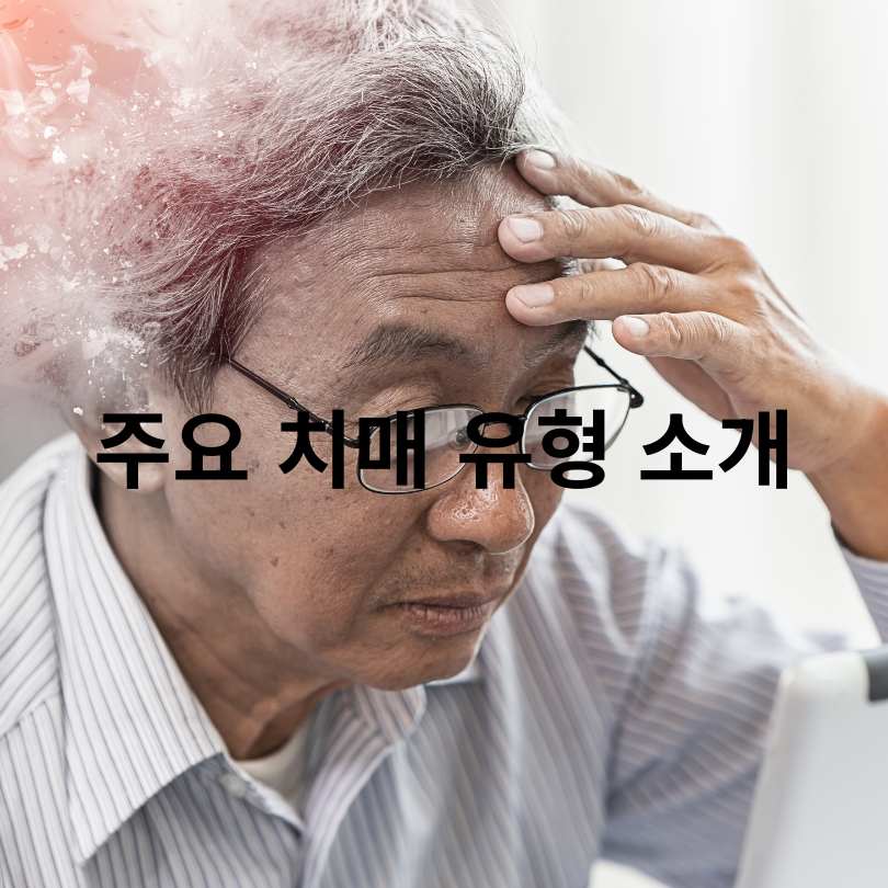 알츠하이머 치매와 혈관성 치매의 차이점