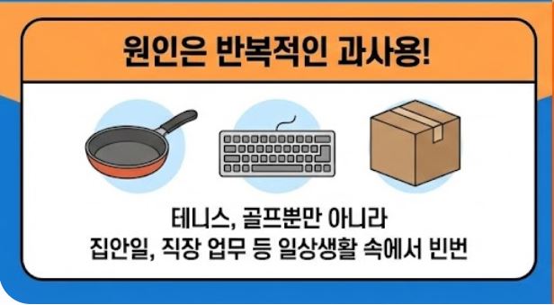 테니스 엘보 치료법