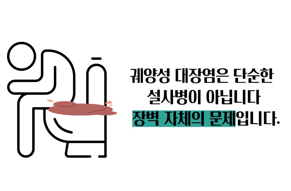 궤양성 대장염