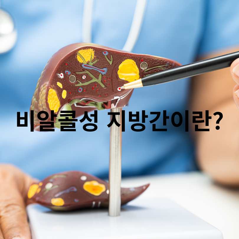비알콜성 지방간 원인과 간수치 상승의 관계