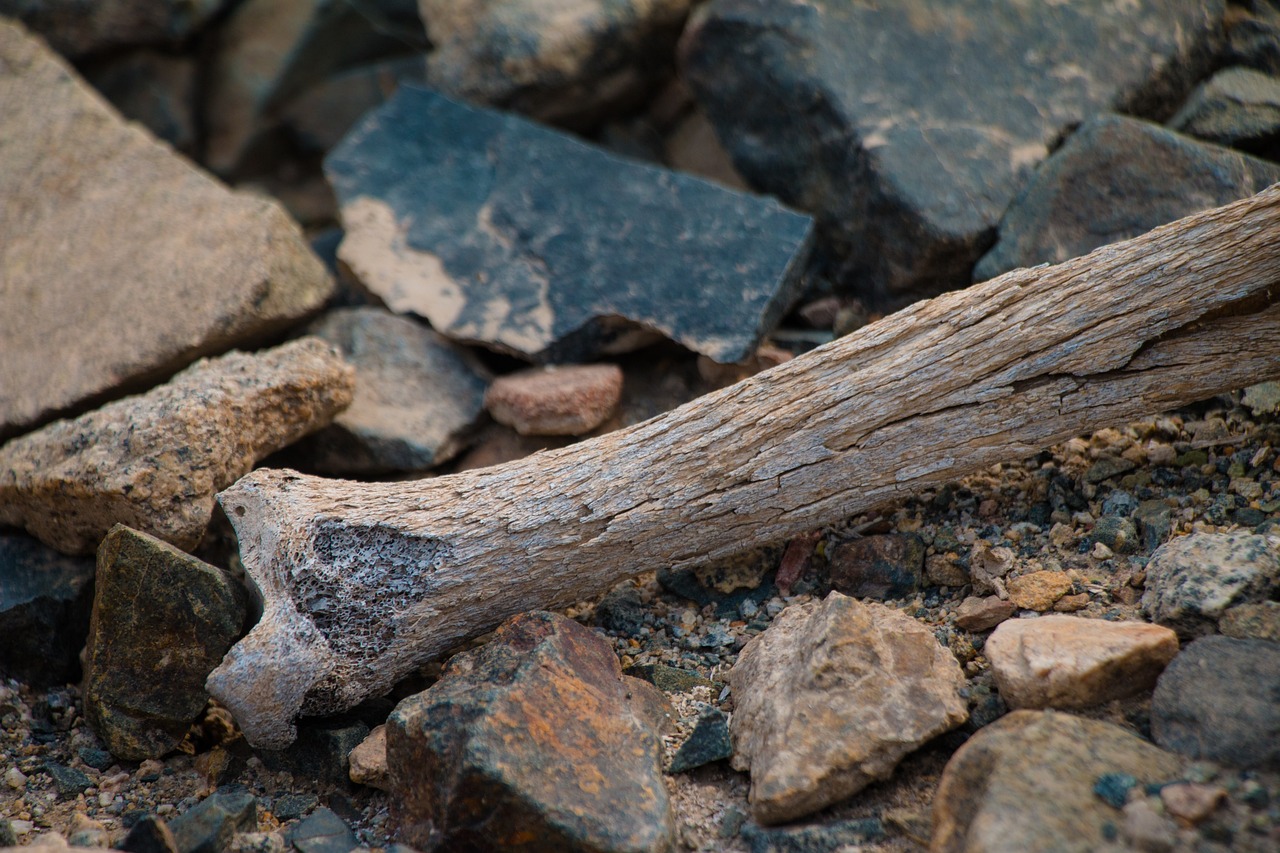 골다공증&#44;골다공증원인&#44;호르몬 변화&#44;유전학&#44;요통&#44;골절&#44;골밀도 검사