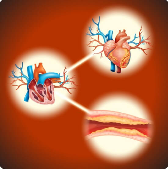 혈관 속 노폐물