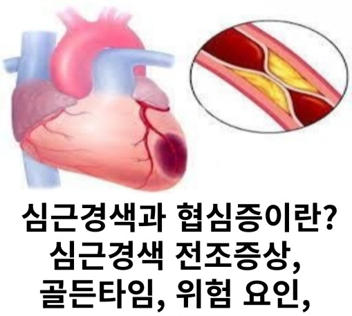 심근경색 전조증상 협심증 전조증상 조기 진단 예방