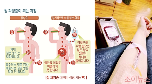 철분 과다 섭취가 발생하는 경우