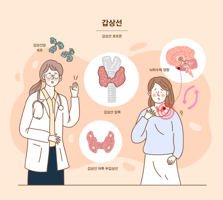 갑상선 결절 증상 및 원인과 치료 기능 저하증 수술 물혹 크기 모양 목에 혹