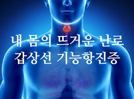 갑상선 기능 항진증의 증상