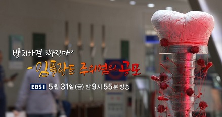 임플란트명의