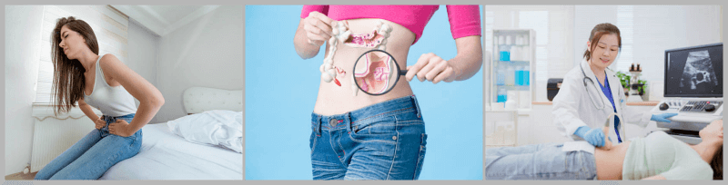 대장암 치료 전문의 베스트 추천 리스트