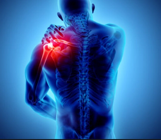 섬유근육통 진단