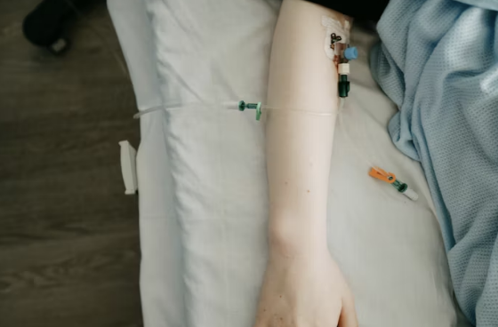 근막구획증후군 압박 붕대 석고 위험
