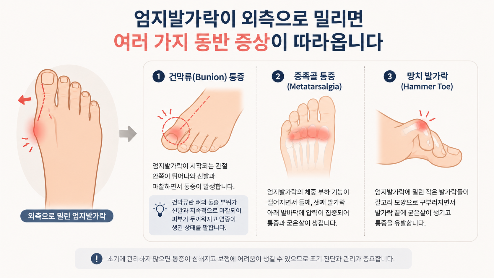 무지외반증 (발 변형, 신발 선택, 예방 관리)