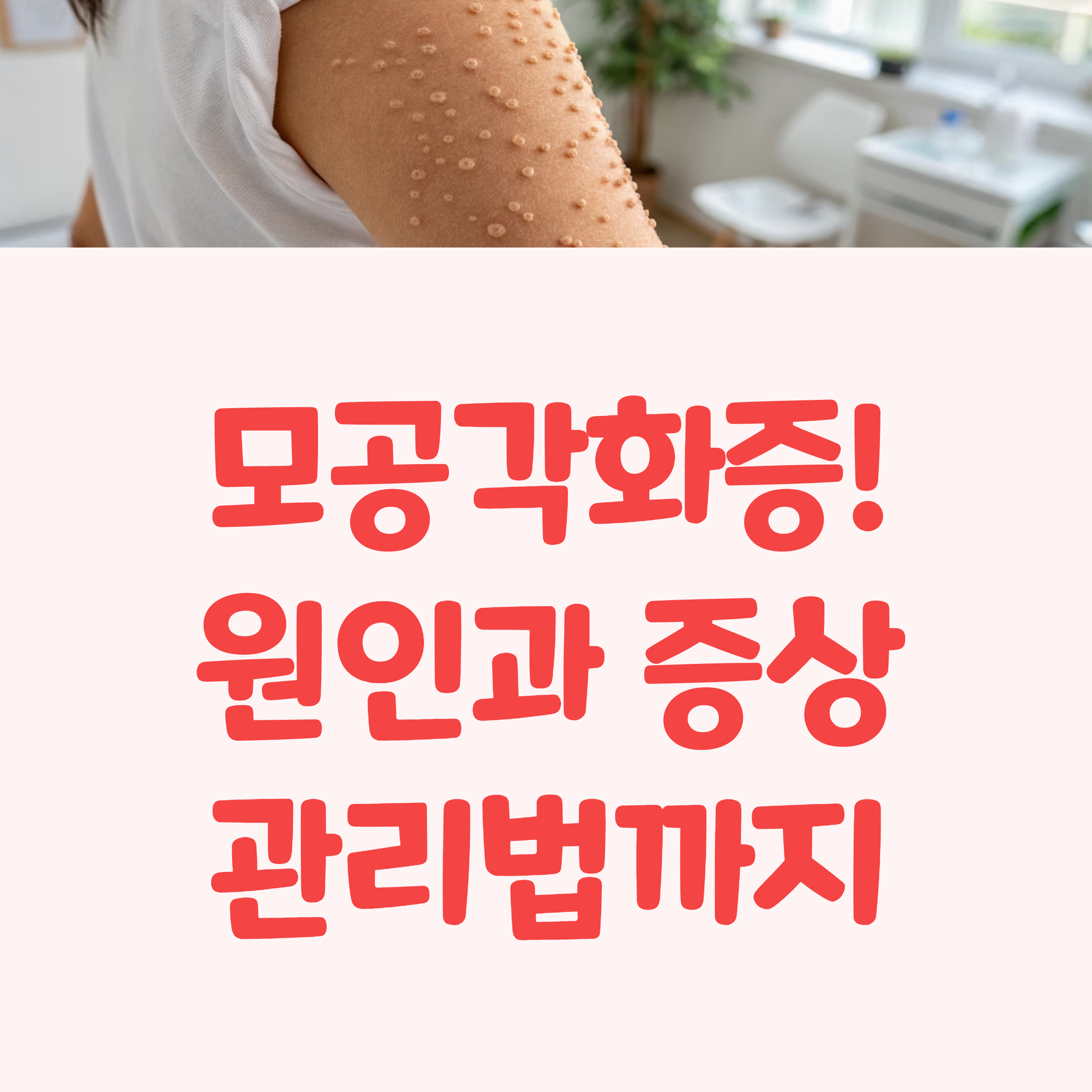 팔 닭살 피부, 모공각화증! 원인과 증상 관리법까지 완벽 가이드