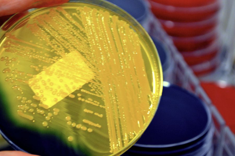 계절이 바뀔 때마다 달라졌던 위생 느낌과 세균막(바이오필름)연관성