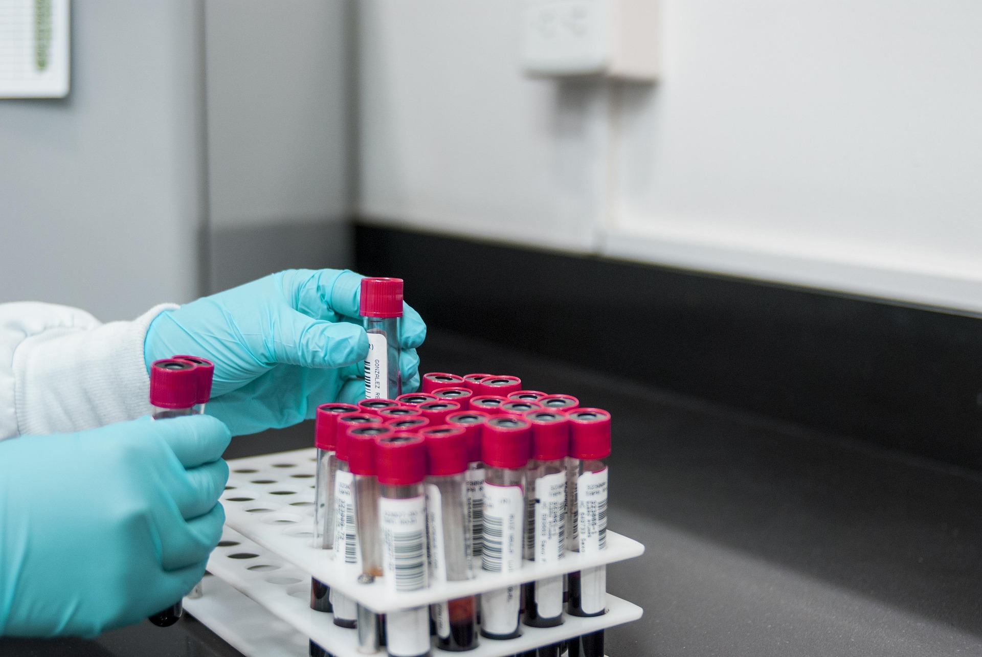 혈액검사 결과지 보는 법 (CBC, 기본 혈액 수치 해석)