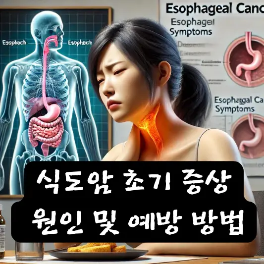 식도암 초기증상 원인 생존률