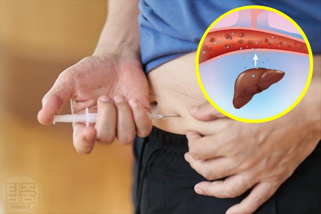 내장지방 2형당뇨병