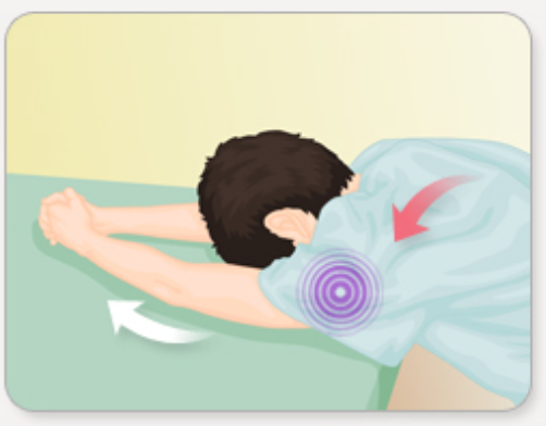 오십견 치료 운동법