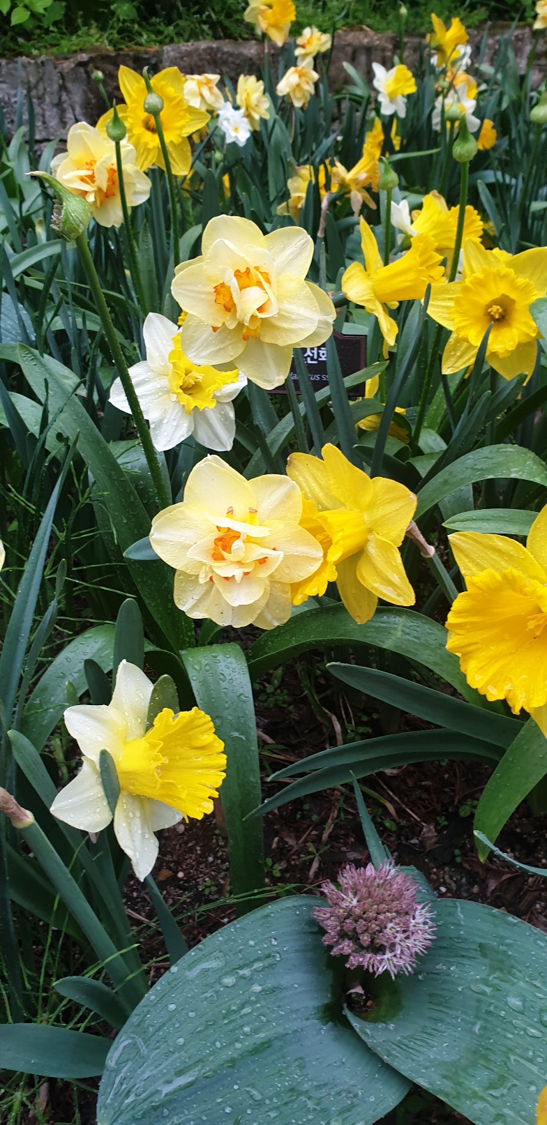 갑상선 기능저하증 초기증상 7가지 총정리(검사비용 포함)