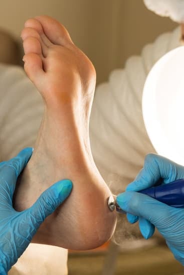 발각질 제거로 예쁜 발 만들기