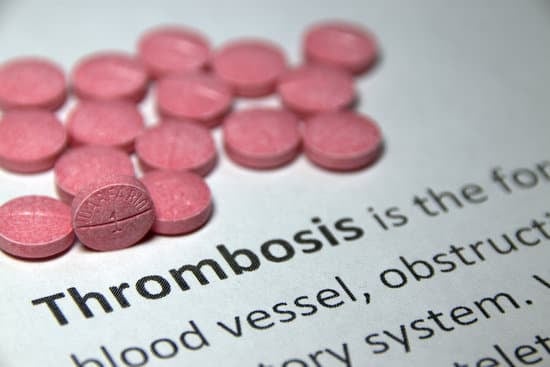 혈전증이 원인과 치료